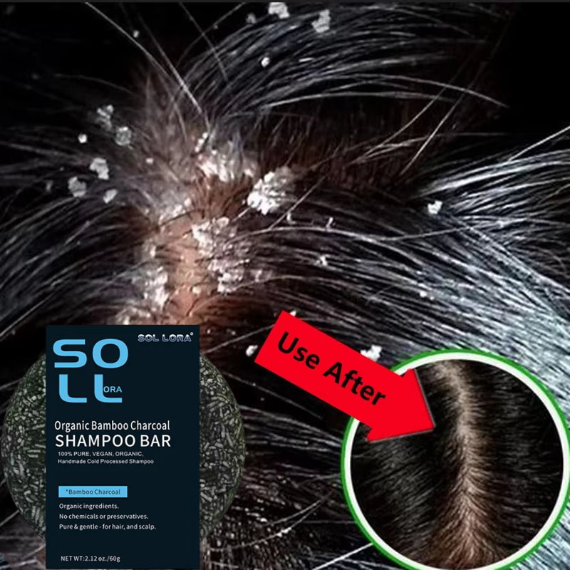 Szybkie mydło do włosów przeci – Hair Care Dandruff recenzja i cena